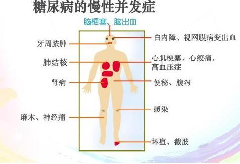 糖尿病患者必知的四个饮食方法，边吃边降血